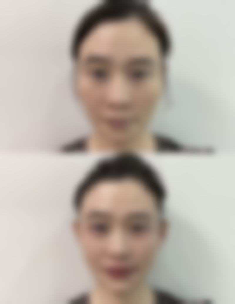 绵阳朗睿整形医院口碑好不好