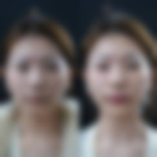 陕西省西安市亚太医疗美容医院口碑评价如何