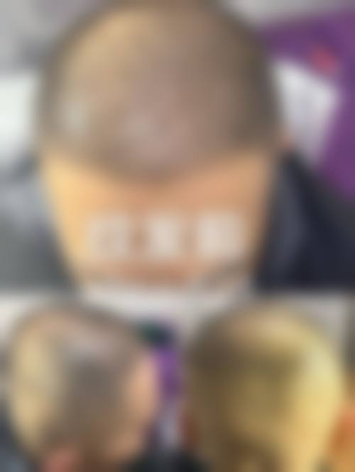 宋银彬医生简介做手术价格