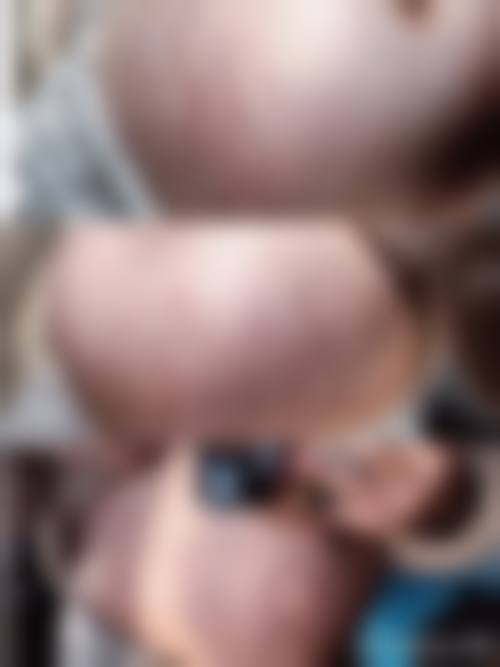 孝感天妃整形的正规性及特色项目