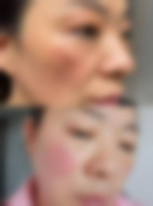 张君霞医生顾客实例图片