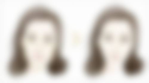 孙黎医生简介口碑如何