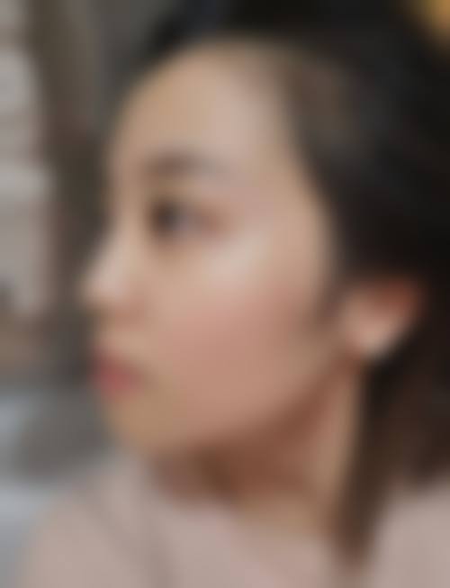梧州除皱整形整形医院服务流程