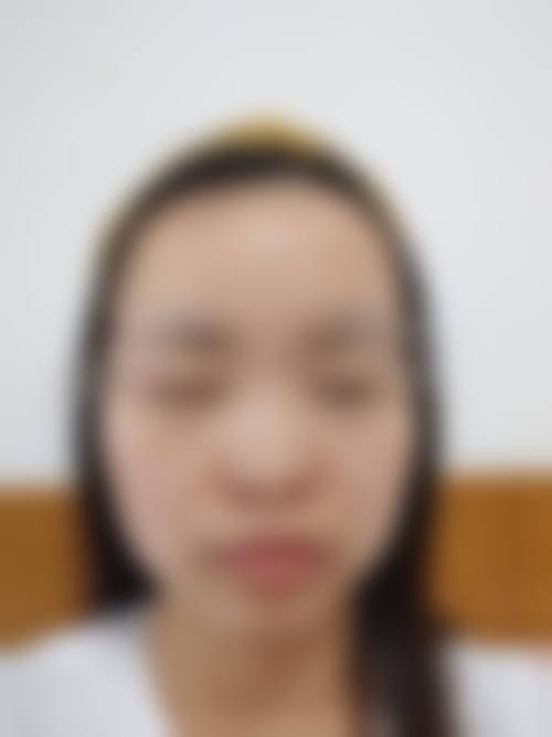 无锡觅森整形医院项目特色