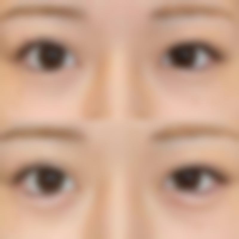 广州唯伊整形美容医院价格表
