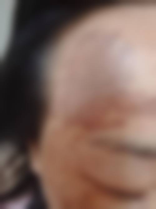 reone皮肤科医院怎么样医生简介
