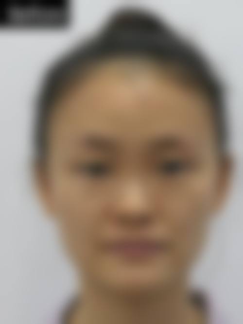 衡水尚美医疗整形中 心资质如何