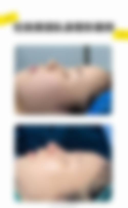 赵升宇医生做手术价格