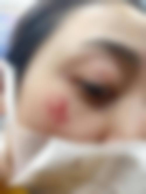 青岛瑧妍美医疗美容医院刘晨涛属于什么档次——青岛臻宝颜商贸