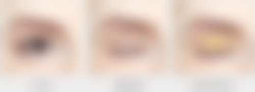 桂林181医院整形科怎么样之口碑好不好？附真实患者口碑评价