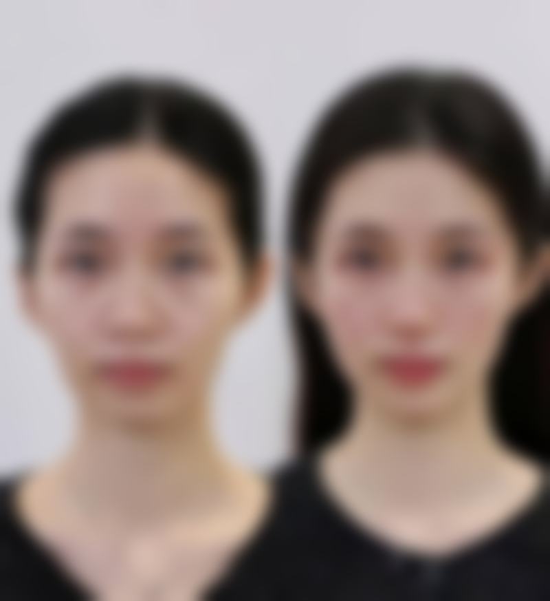 吴海霞医生做手术价格