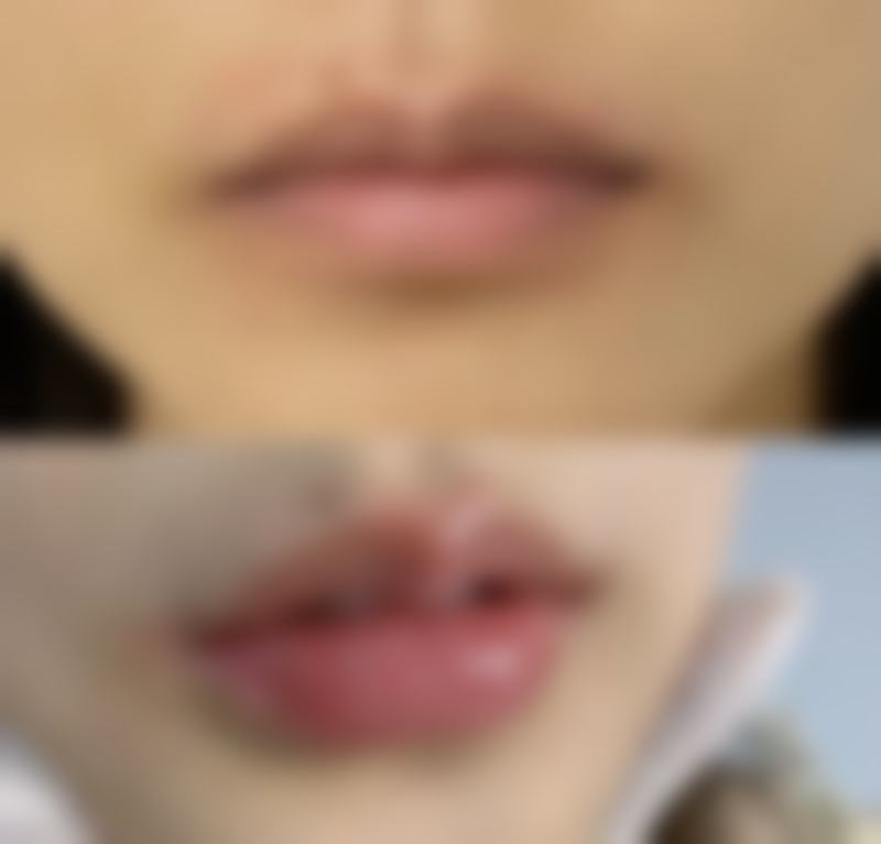 王胜利医生简介项目优势
