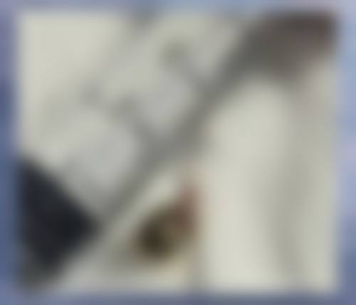 李瑶医生简介做手术价格