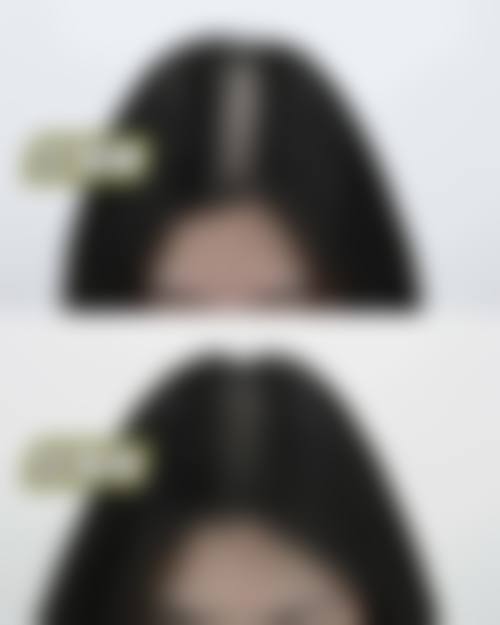 贵阳发博士植发医院口碑评价