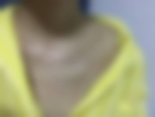 ISTAR整形外科医院价格表