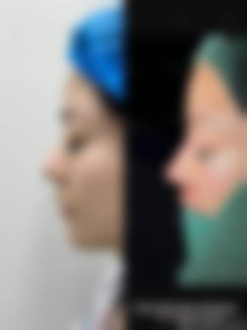 深圳吴波皮肤美容科诊所更擅长什么手术
