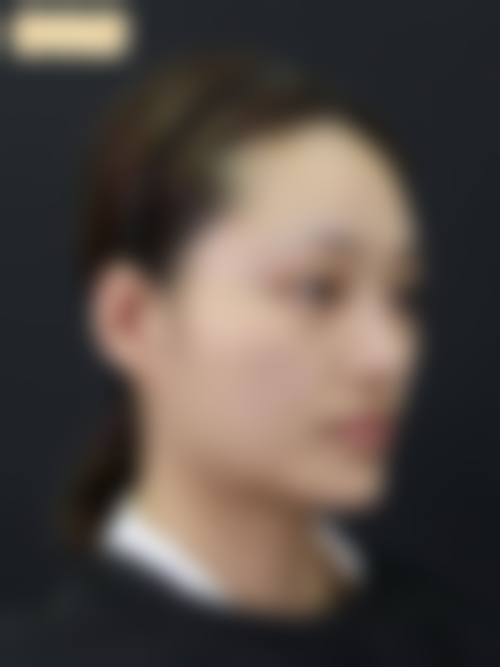 菏泽恩缇整形医院项目特色