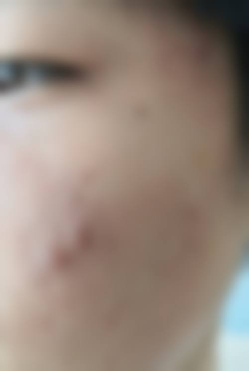 林肖医生简介怎么挂号