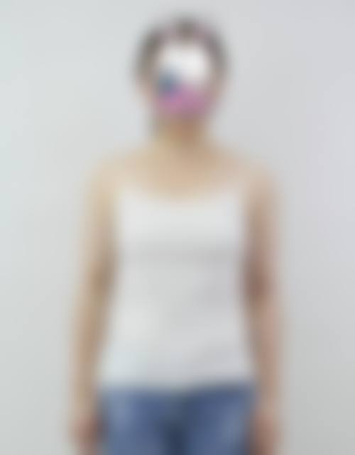 温岭维多利亚整形价格表