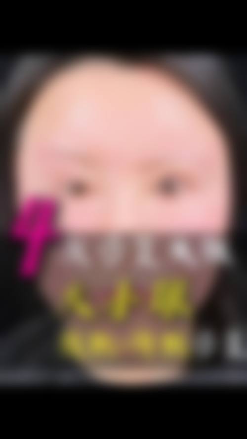 患者真实评价 钱尼文医生