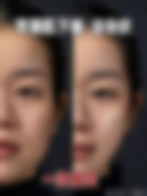 擅长项目详解 钱尼文医生