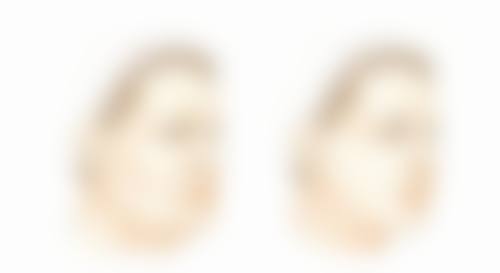 临床实例分享