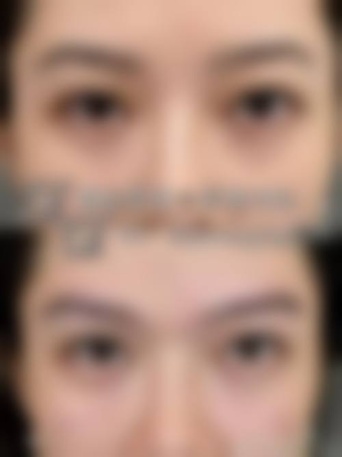 优惠活动详情:美丽无忧,超值体验