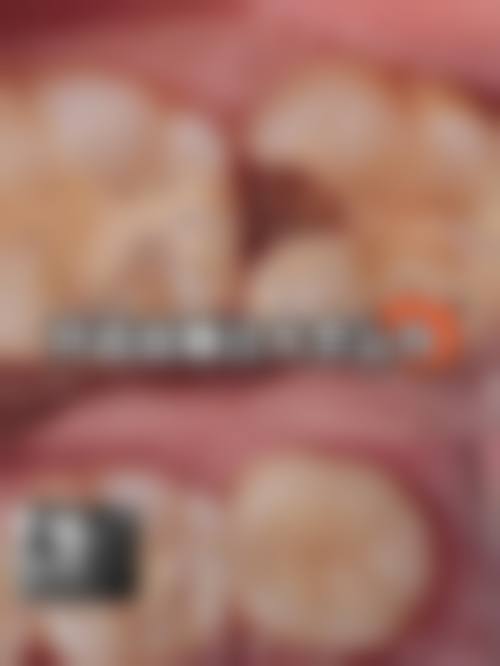 预约优惠活动