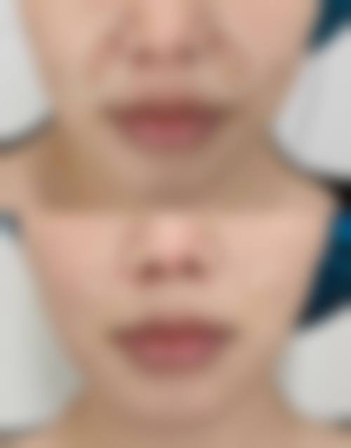 服务流程与患者保护:专精细致,全程呵护