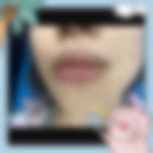 特色项目介绍:覆盖整形与轻医美