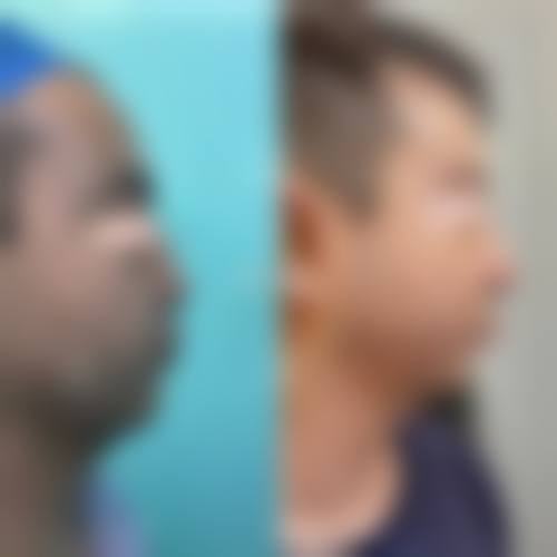 特色项目与核心设备:个性化方案是关键
