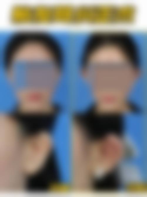 擅长项目详解