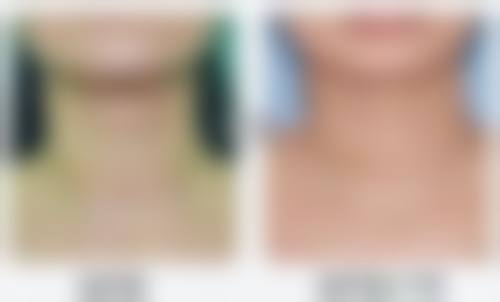 常见问题解答(FAQ)