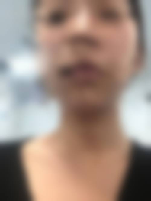 问:郑州天美整形美容的医生专精吗?