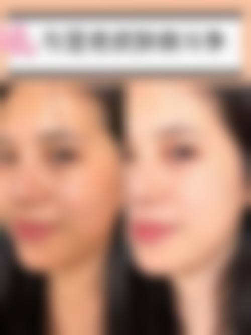 优惠活动详情:原价对比清晰,预约即享补贴