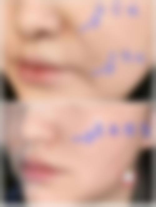 预约优惠活动