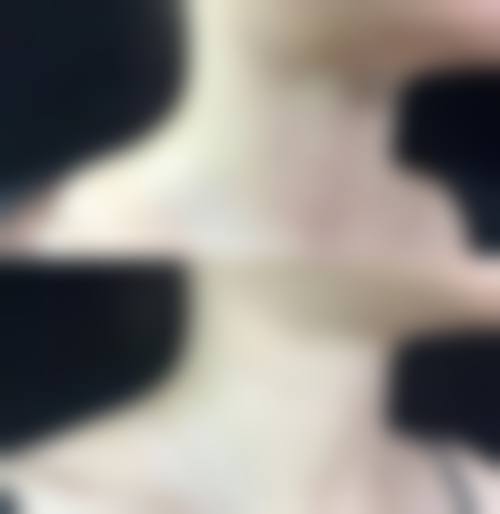 擅长项目详解