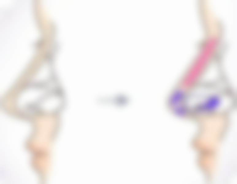 临床实例分享