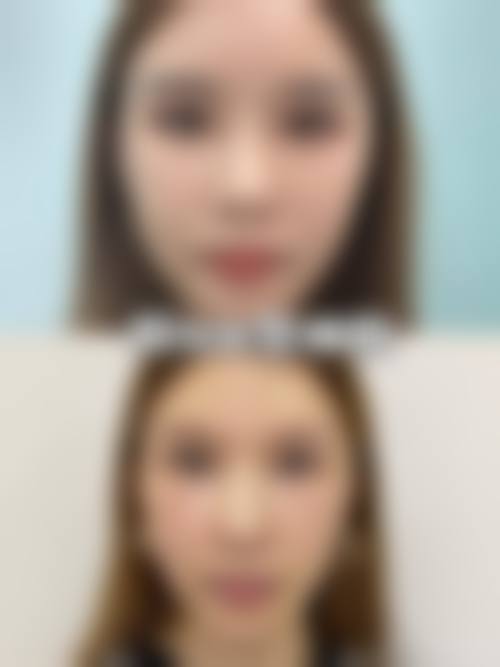 特色项目与个性化方案:精细解决您的美丽诉求