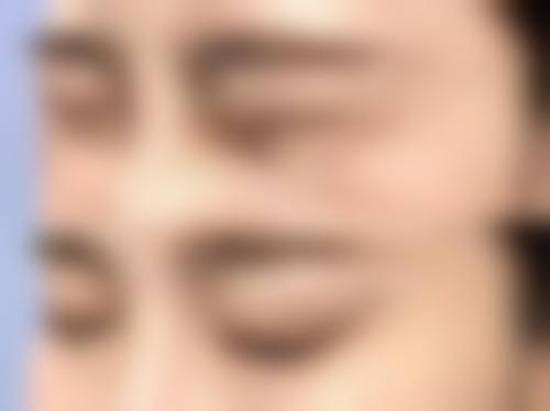 临床实例分享——江光明医生临床实例分享
