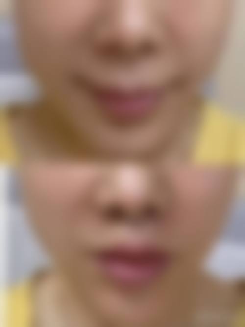 特色科室与项目:皮肤管理与微整形并重