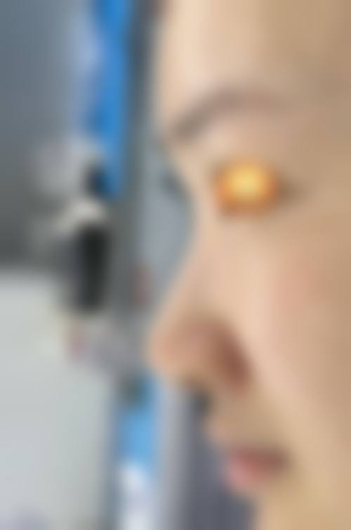 临床实例分享