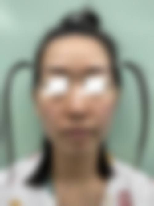 擅长项目详解——江光明医生擅长项目详解