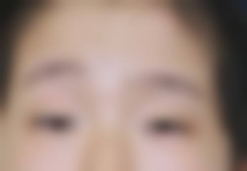 服务流程与患者保护:从询问到术后无忧