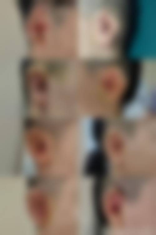 临床实例分享