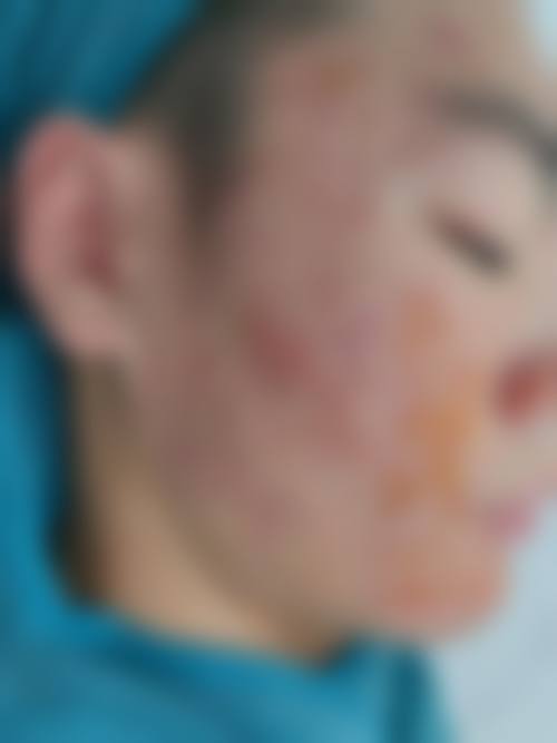 服务流程与患者保护:全程无忧,贴心守护