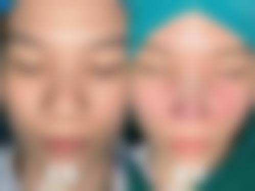擅长项目详解