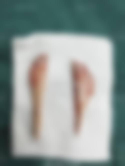 临床实例分享