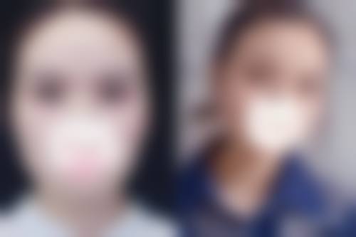擅长项目详解
