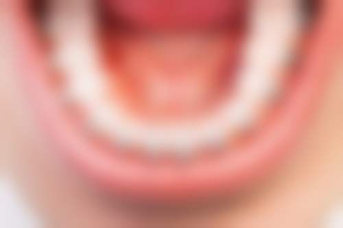 临床实例分享